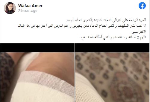 وفاء عامر تتعرض لكدمات شديدة وتطلب الدعاء من جمهورها | الفن | جريدة الطريق